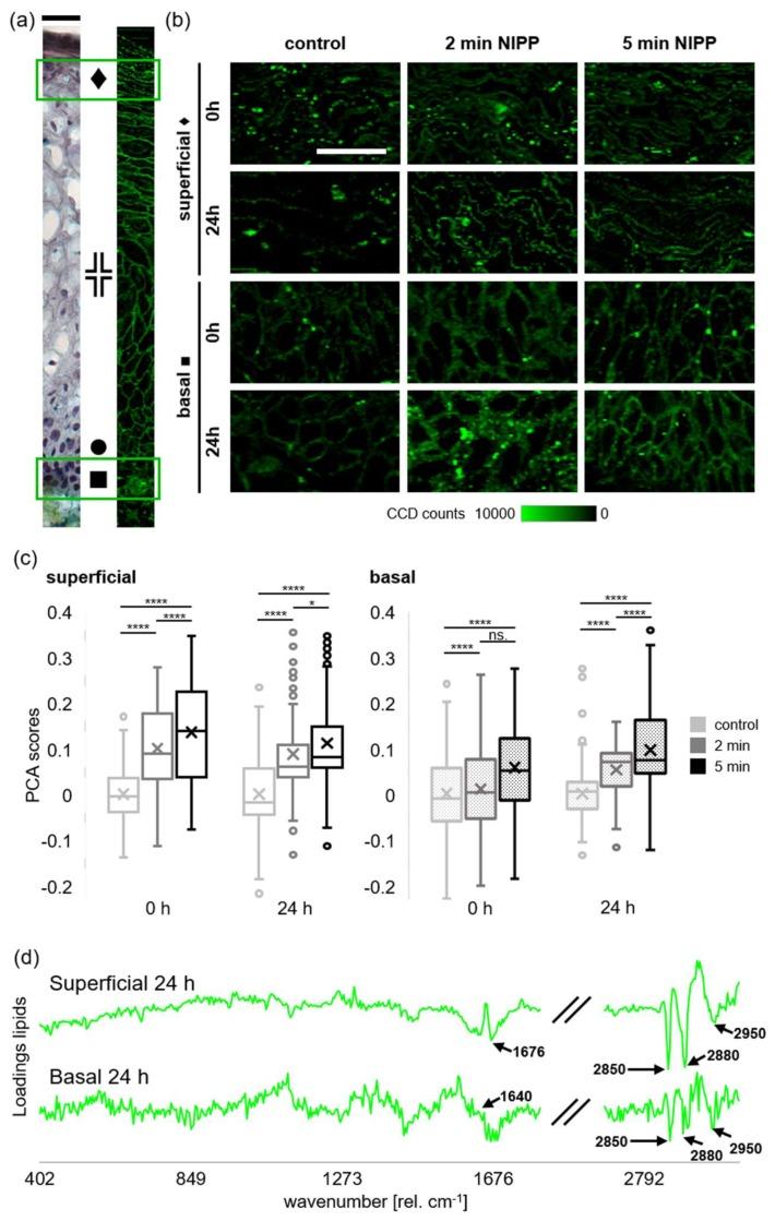 https://cdn.ncbi.nlm.nih.gov/pmc/blobs/d91c/7072402/ff449dd1ddea/cancers-12-00267-g005.jpg