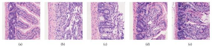 https://cdn.ncbi.nlm.nih.gov/pmc/blobs/d91d/5266813/3f4638929d62/ECAM2017-7350251.005.jpg