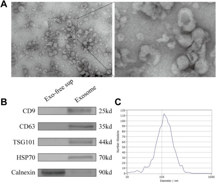 https://cdn.ncbi.nlm.nih.gov/pmc/blobs/d91f/12378562/40c8b06fb9f9/IID3-13-e70251-g003.jpg