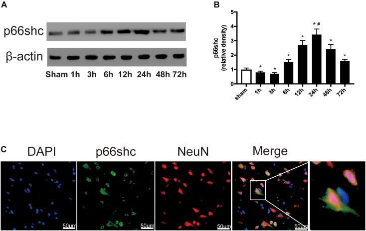 https://cdn.ncbi.nlm.nih.gov/pmc/blobs/d921/6411796/60005866bf9e/fnins-13-00026-g001.jpg