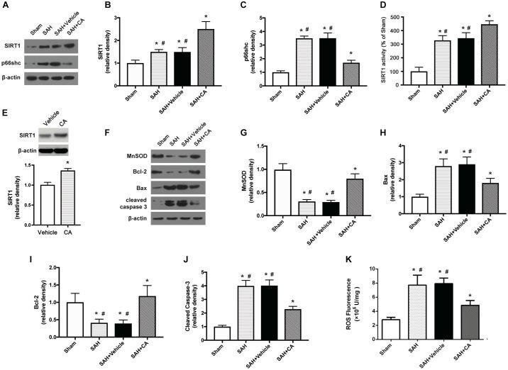 https://cdn.ncbi.nlm.nih.gov/pmc/blobs/d921/6411796/9bb298380dc9/fnins-13-00026-g003.jpg