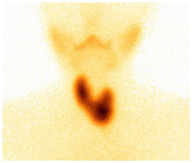 https://cdn.ncbi.nlm.nih.gov/pmc/blobs/d922/5588167/27b3b8ec3050/ol-14-03-2903-g01.jpg