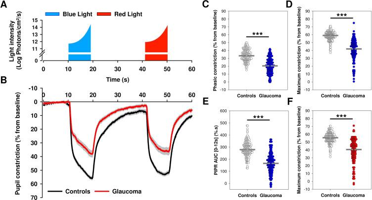 https://cdn.ncbi.nlm.nih.gov/pmc/blobs/d925/10176376/979143b9a970/bjophthalmol-2021-319938f02.jpg