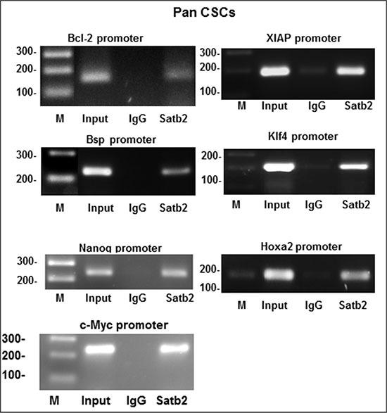 https://cdn.ncbi.nlm.nih.gov/pmc/blobs/d925/5295389/07e4536369e1/oncotarget-07-57783-g003.jpg