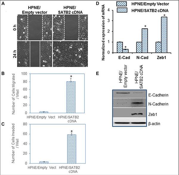 https://cdn.ncbi.nlm.nih.gov/pmc/blobs/d925/5295389/9a22e5bf2ef9/oncotarget-07-57783-g004.jpg