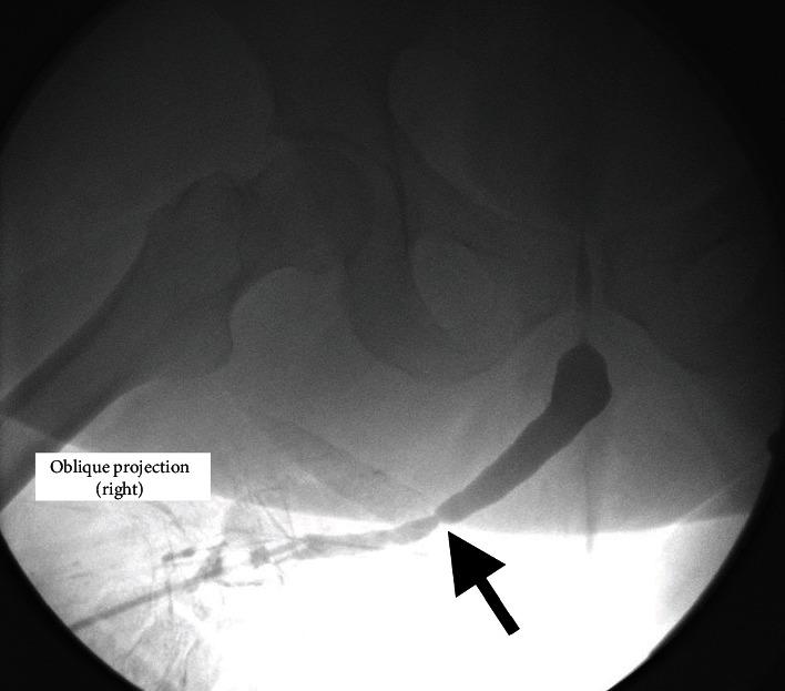 https://cdn.ncbi.nlm.nih.gov/pmc/blobs/d929/7815407/4dc59e52b70d/CRIU2021-6656540.002.jpg