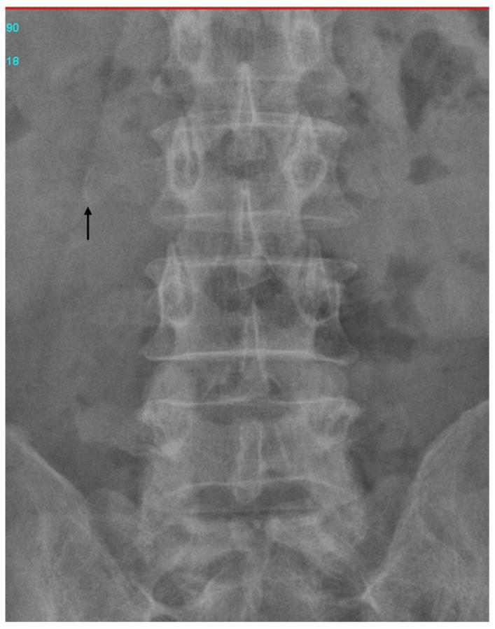 https://cdn.ncbi.nlm.nih.gov/pmc/blobs/d935/9599985/f08e94c02e83/diagnostics-12-02276-g003.jpg