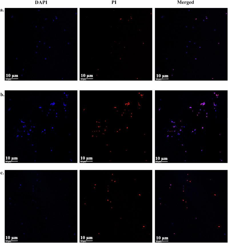 https://cdn.ncbi.nlm.nih.gov/pmc/blobs/d936/12134374/01e8626161fb/41522_2025_728_Fig5_HTML.jpg