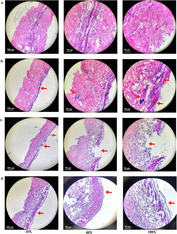 https://cdn.ncbi.nlm.nih.gov/pmc/blobs/d936/12134374/0ec6dcd150fa/41522_2025_728_Fig7_HTML.jpg