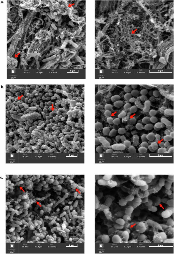 https://cdn.ncbi.nlm.nih.gov/pmc/blobs/d936/12134374/d8d1bacfbf89/41522_2025_728_Fig9_HTML.jpg