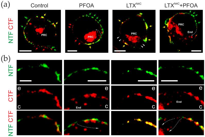 https://cdn.ncbi.nlm.nih.gov/pmc/blobs/d936/12300799/2c013fc5d14a/toxins-17-00359-g005.jpg