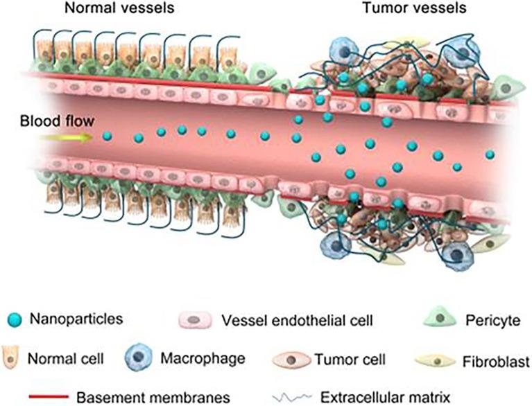https://cdn.ncbi.nlm.nih.gov/pmc/blobs/d938/8784389/55211848583c/fonc-11-789330-g002.jpg