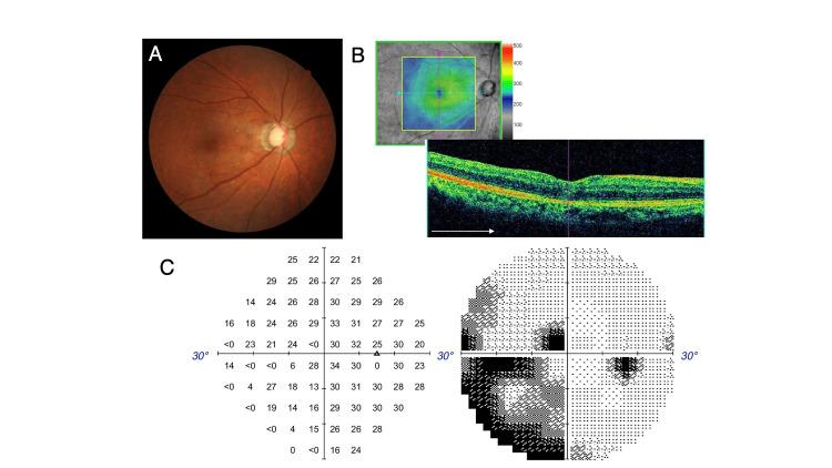 https://cdn.ncbi.nlm.nih.gov/pmc/blobs/d945/11374924/7b3a6a00dc2e/cureus-0016-00000066232-i06.jpg