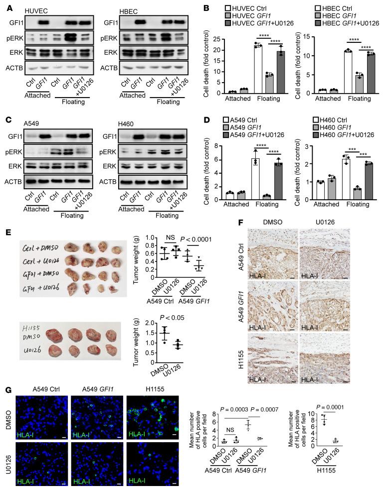 https://cdn.ncbi.nlm.nih.gov/pmc/blobs/d94a/9433100/92ce890e94ce/jci-132-149551-g059.jpg