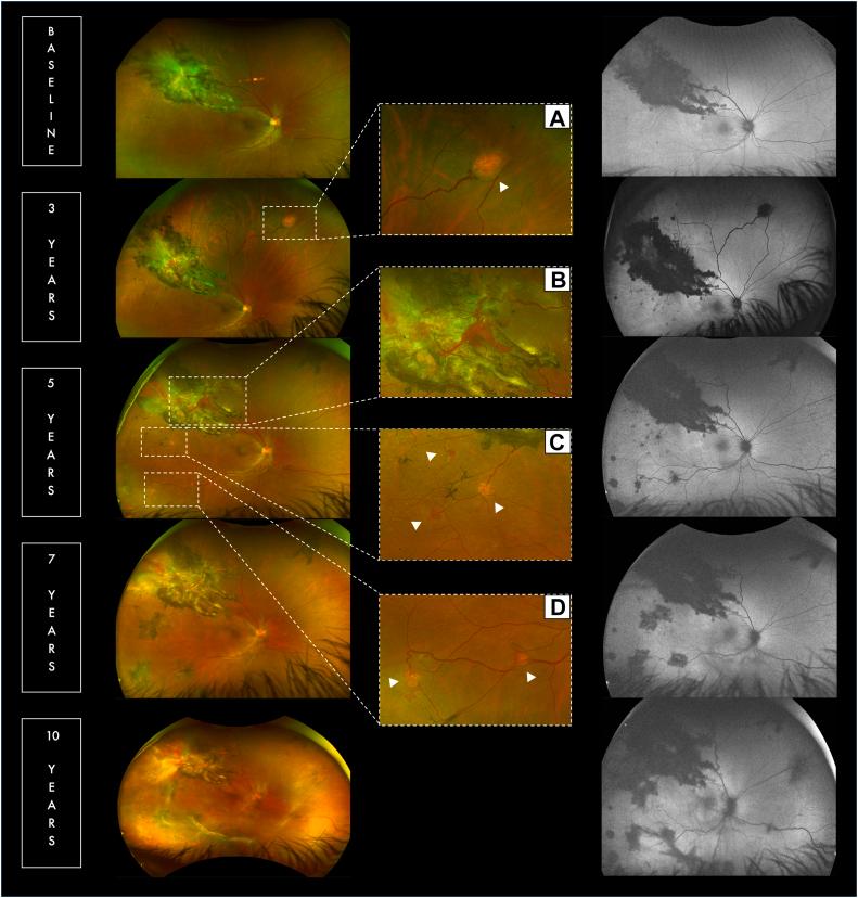 https://cdn.ncbi.nlm.nih.gov/pmc/blobs/d94b/12249371/aab9eec6133f/gr3.jpg