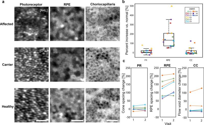 https://cdn.ncbi.nlm.nih.gov/pmc/blobs/d94c/9470576/25c3f40449c9/42003_2022_3842_Fig3_HTML.jpg