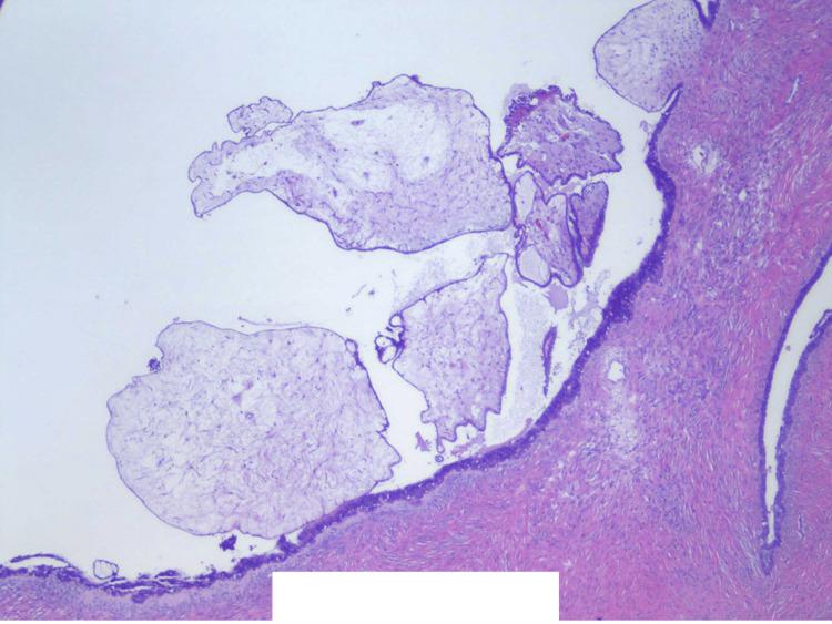 https://cdn.ncbi.nlm.nih.gov/pmc/blobs/d94e/12311399/50411456af29/cureus-0017-00000087081-i07.jpg