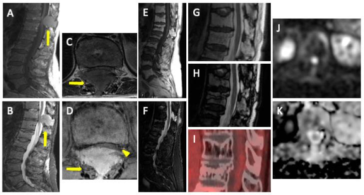 https://cdn.ncbi.nlm.nih.gov/pmc/blobs/d94f/10780302/20819f110deb/jcm-13-00264-g008.jpg