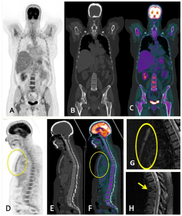 https://cdn.ncbi.nlm.nih.gov/pmc/blobs/d94f/10780302/59408a3633fe/jcm-13-00264-g003.jpg