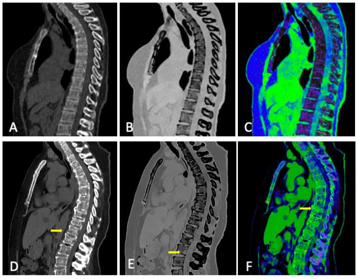 https://cdn.ncbi.nlm.nih.gov/pmc/blobs/d94f/10780302/5b3eb7d49a3e/jcm-13-00264-g005.jpg