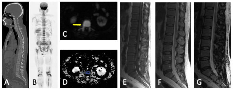 https://cdn.ncbi.nlm.nih.gov/pmc/blobs/d94f/10780302/a4958ba998ce/jcm-13-00264-g007.jpg