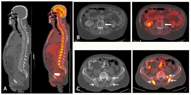https://cdn.ncbi.nlm.nih.gov/pmc/blobs/d94f/10780302/a7f5810625a7/jcm-13-00264-g009.jpg