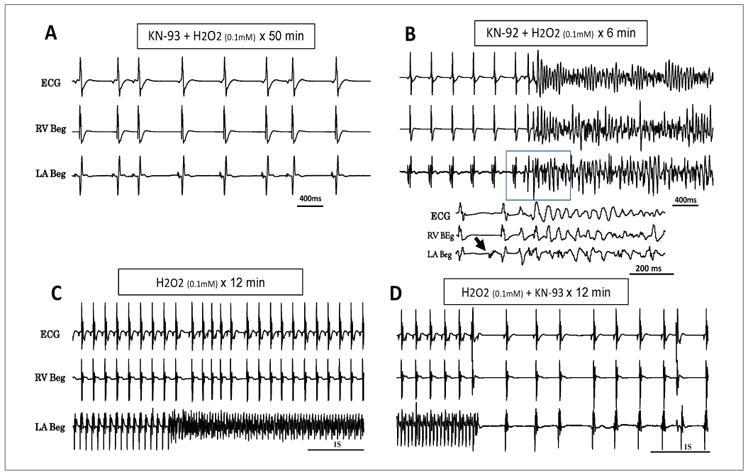 https://cdn.ncbi.nlm.nih.gov/pmc/blobs/d950/6214459/c4cfbbe5d007/nihms979966f3.jpg