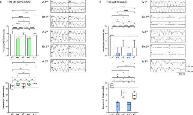 https://cdn.ncbi.nlm.nih.gov/pmc/blobs/d95a/12181435/0eb2e88e454b/41598_2025_6440_Fig2_HTML.jpg