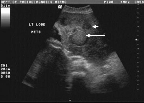 https://cdn.ncbi.nlm.nih.gov/pmc/blobs/d95a/509249/9f9e6e51591b/1471-2407-4-41-2.jpg