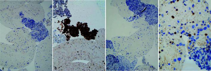 https://cdn.ncbi.nlm.nih.gov/pmc/blobs/d95b/10627364/29c973400aef/jh-12-236-g004.jpg