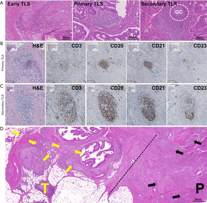 https://cdn.ncbi.nlm.nih.gov/pmc/blobs/d95f/12078838/6d9ca7aec4b2/jgo-16-02-386-f3.jpg