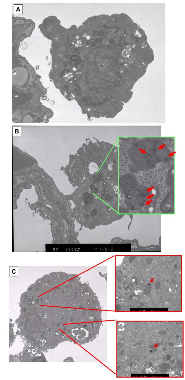 https://cdn.ncbi.nlm.nih.gov/pmc/blobs/d963/2848185/3c48063b9c07/1743-8977-7-4-12.jpg