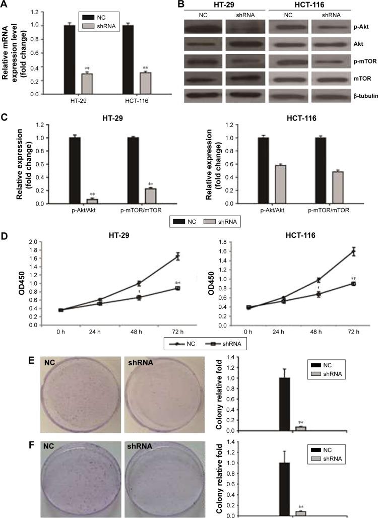 https://cdn.ncbi.nlm.nih.gov/pmc/blobs/d964/5602681/997d405b7c34/ott-10-4413Fig2.jpg