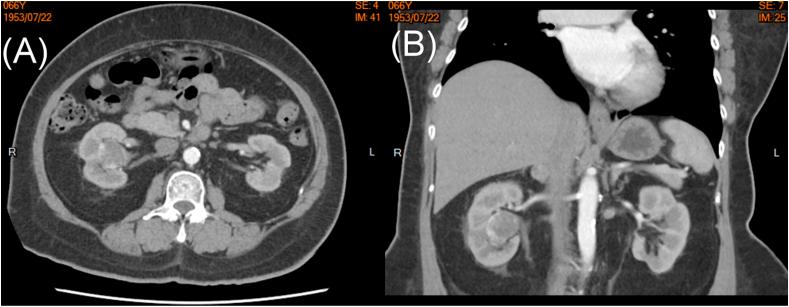 https://cdn.ncbi.nlm.nih.gov/pmc/blobs/d969/7596193/1ee8cd1bfcd2/gr1.jpg