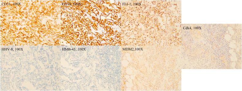 https://cdn.ncbi.nlm.nih.gov/pmc/blobs/d969/7596193/7b6aa5f8a032/gr3.jpg
