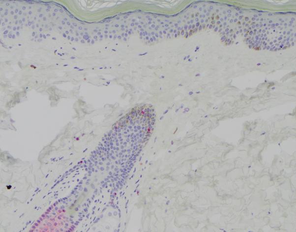https://cdn.ncbi.nlm.nih.gov/pmc/blobs/d979/9523092/35a10777666c/gr3.jpg
