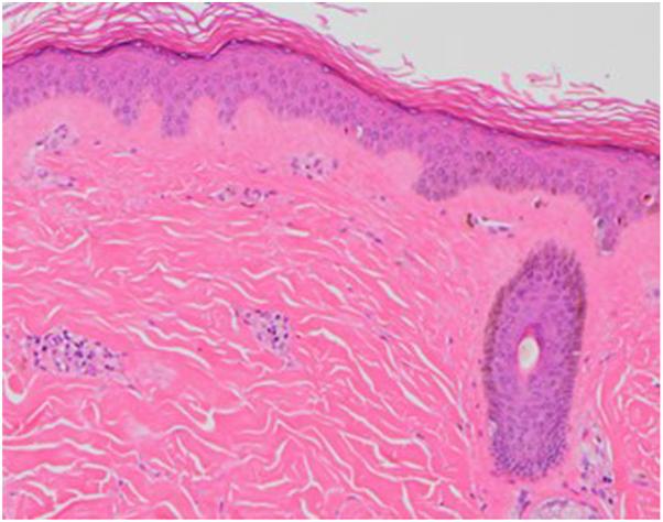https://cdn.ncbi.nlm.nih.gov/pmc/blobs/d979/9523092/4434aef06171/gr4.jpg