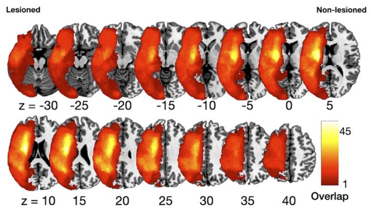 https://cdn.ncbi.nlm.nih.gov/pmc/blobs/d97c/8301903/845ca4475b40/brainsci-11-00870-g001.jpg