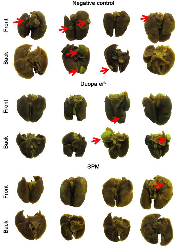 https://cdn.ncbi.nlm.nih.gov/pmc/blobs/d984/4023534/01636280071c/1471-2407-14-329-12.jpg