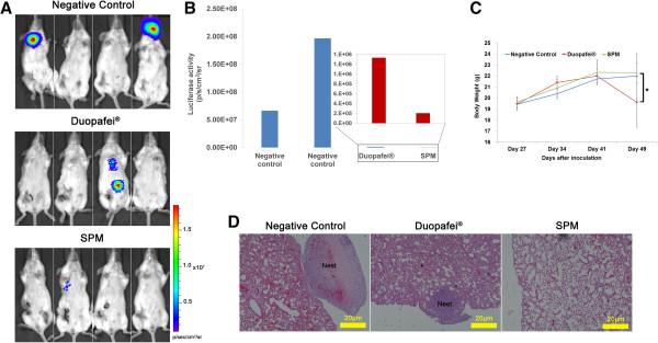 https://cdn.ncbi.nlm.nih.gov/pmc/blobs/d984/4023534/497719d3e0da/1471-2407-14-329-11.jpg