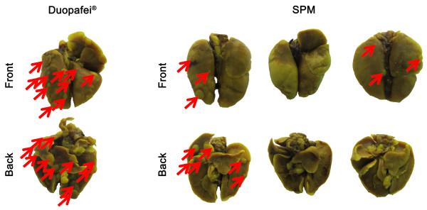 https://cdn.ncbi.nlm.nih.gov/pmc/blobs/d984/4023534/5a5496fc25a0/1471-2407-14-329-5.jpg