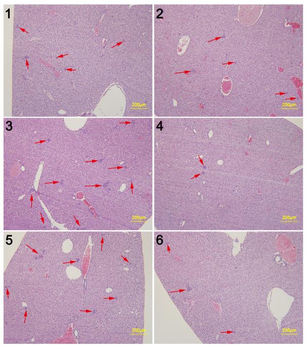 https://cdn.ncbi.nlm.nih.gov/pmc/blobs/d984/4023534/5d9ad8c12088/1471-2407-14-329-10.jpg