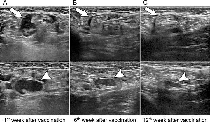 https://cdn.ncbi.nlm.nih.gov/pmc/blobs/d984/9527338/a1e9369e6b6c/radiol.220543.fig3.jpg