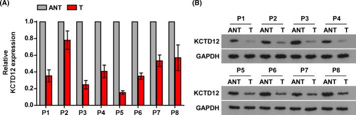 https://cdn.ncbi.nlm.nih.gov/pmc/blobs/d985/7439418/e07ea01a09b4/JCLA-34-e23315-g003.jpg