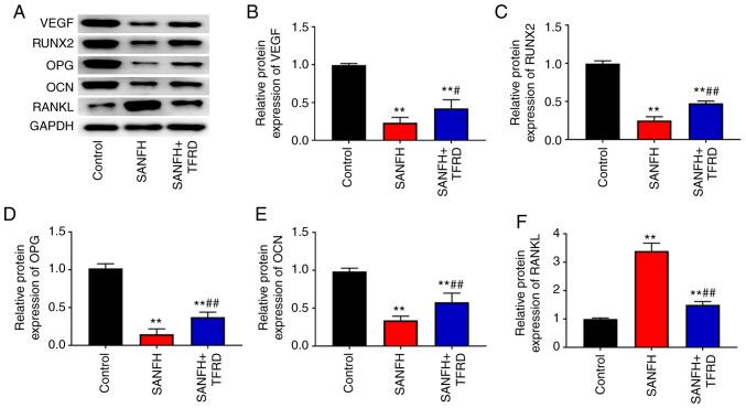 https://cdn.ncbi.nlm.nih.gov/pmc/blobs/d986/7974407/1ab0166948c3/mmr-23-05-11984-g01.jpg