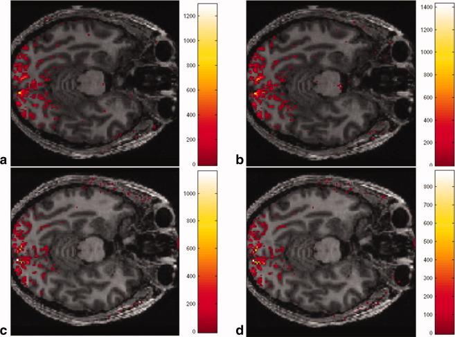 https://cdn.ncbi.nlm.nih.gov/pmc/blobs/d988/4495253/971c7c4b5c6d/mrm0069-1657-f4.jpg