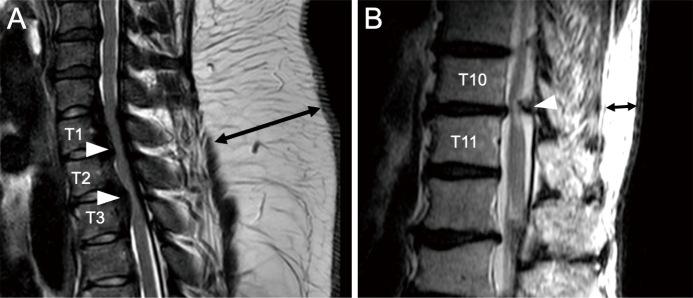 https://cdn.ncbi.nlm.nih.gov/pmc/blobs/d98e/11153844/224d15d7404a/1349-8029-64-0184-g001.jpg