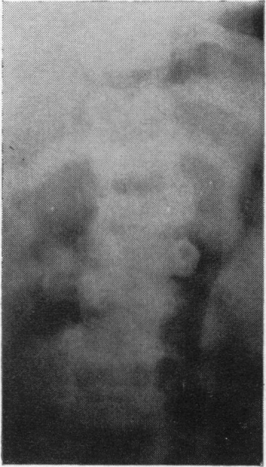 https://cdn.ncbi.nlm.nih.gov/pmc/blobs/d99a/2011541/7aec95241ef4/archdisch01640-0017-d.jpg