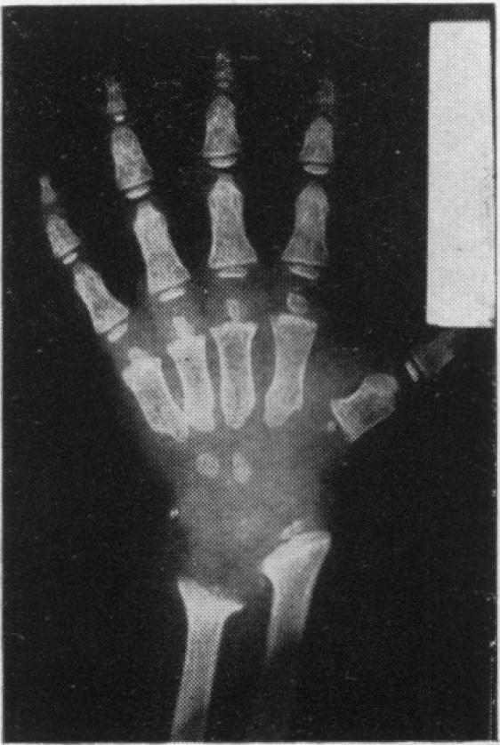 https://cdn.ncbi.nlm.nih.gov/pmc/blobs/d99a/2011541/7d46d8656476/archdisch01640-0018-f.jpg