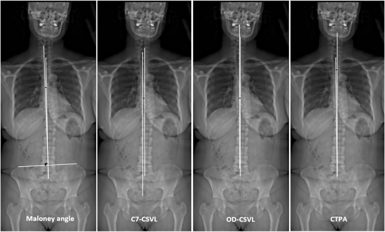 https://cdn.ncbi.nlm.nih.gov/pmc/blobs/d99c/11736157/15dd09b17579/gr2.jpg